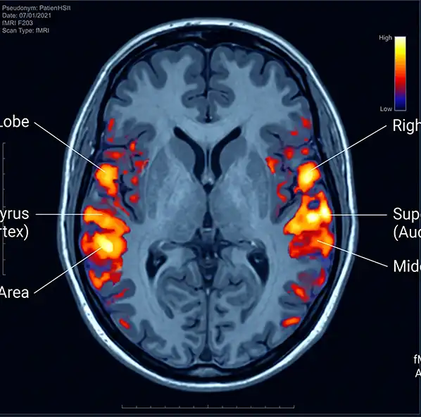 Neuroscience Confirms Julian Jaynes’s Neurological Model